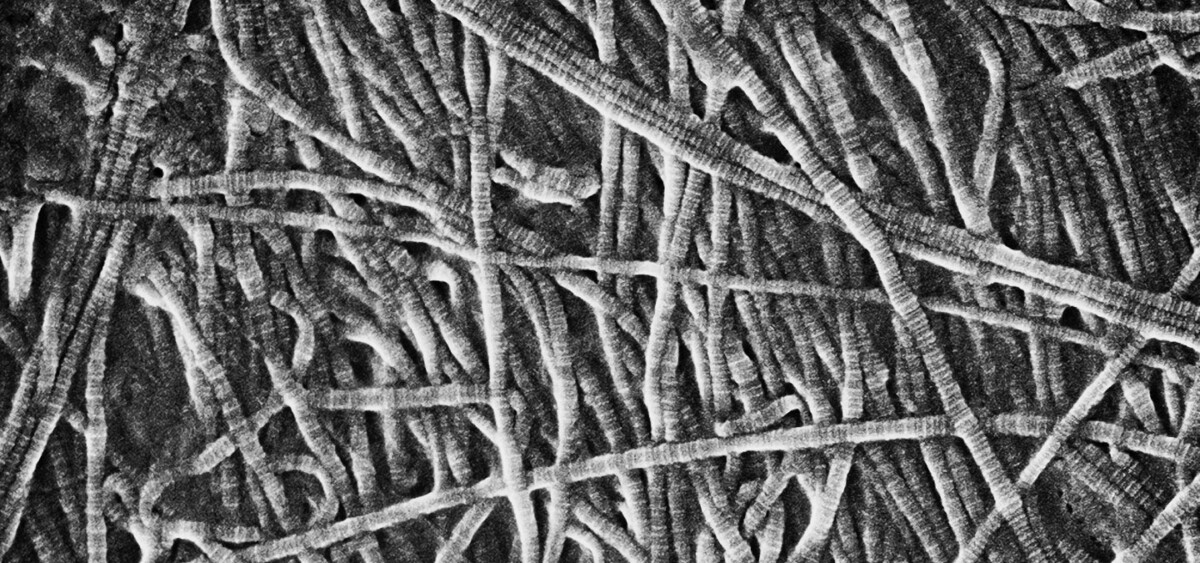 Regenative Labs announces groundbreaking Wharton's Jelly research demonstrating HCT/P compliance after processing